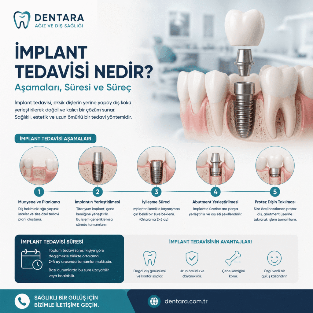 implant tedavisi nedir
